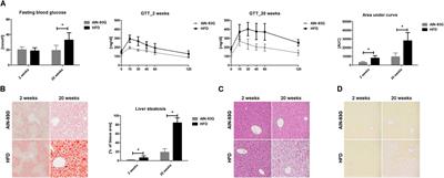 LSEC Fenestrae Are Preserved Despite Pro-inflammatory Phenotype of Liver Sinusoidal Endothelial Cells in Mice on High Fat Diet